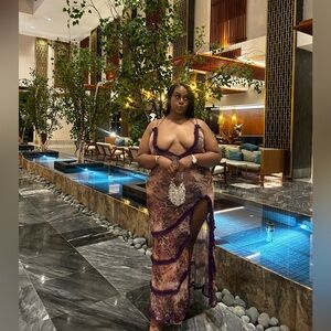 Elegant Lace Trimmed Dress